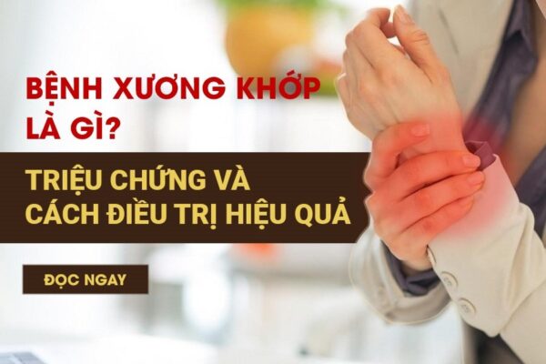 bệnh xương khớp