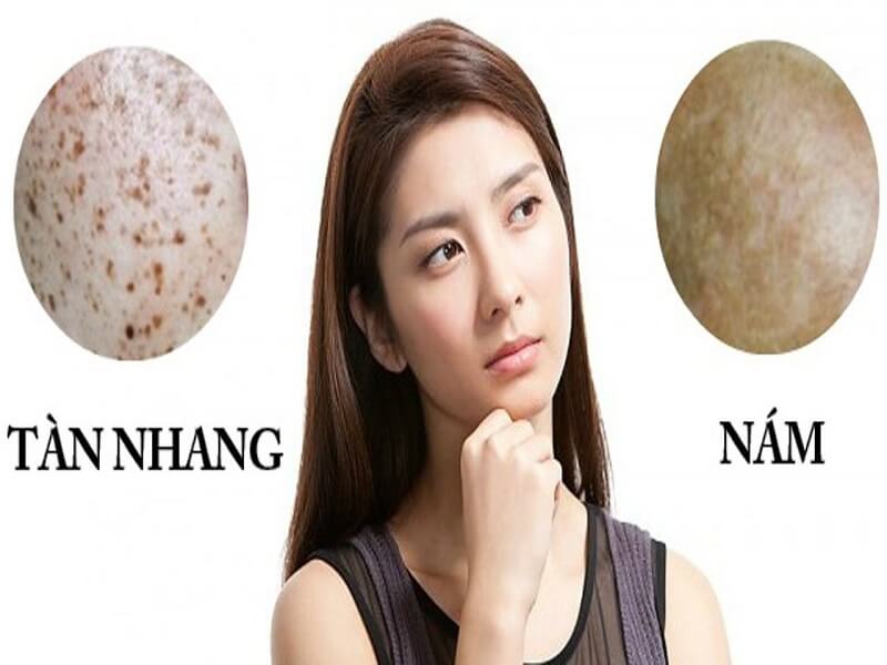 cach tri tham nam sau sinh